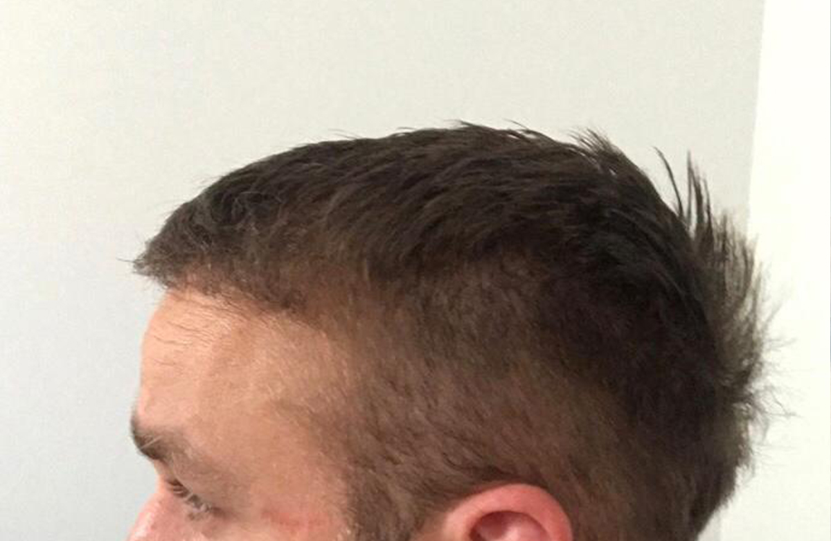after-1