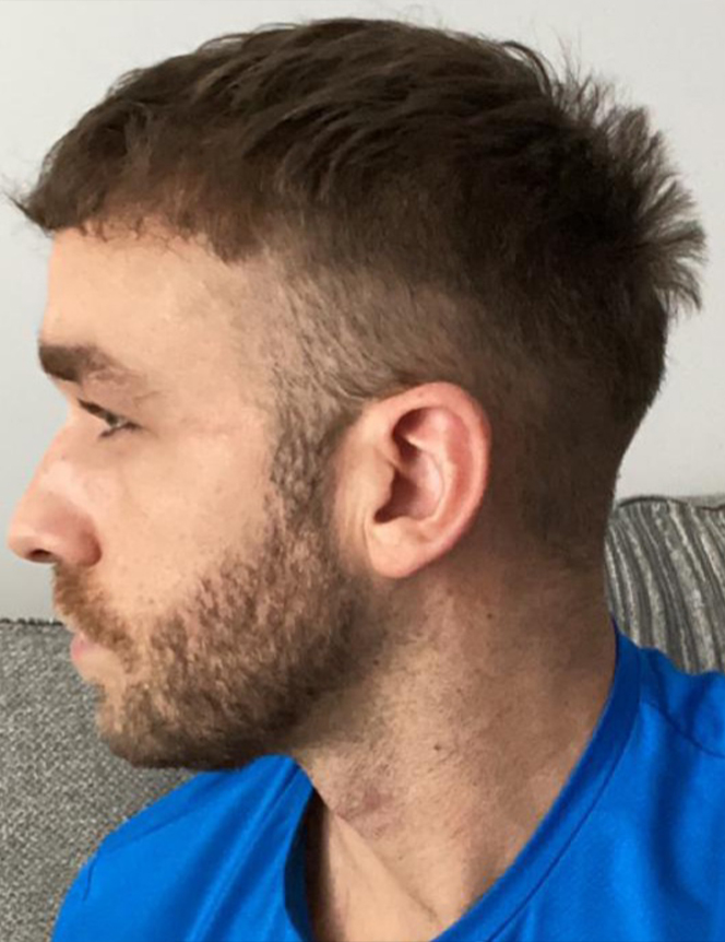after-jt1