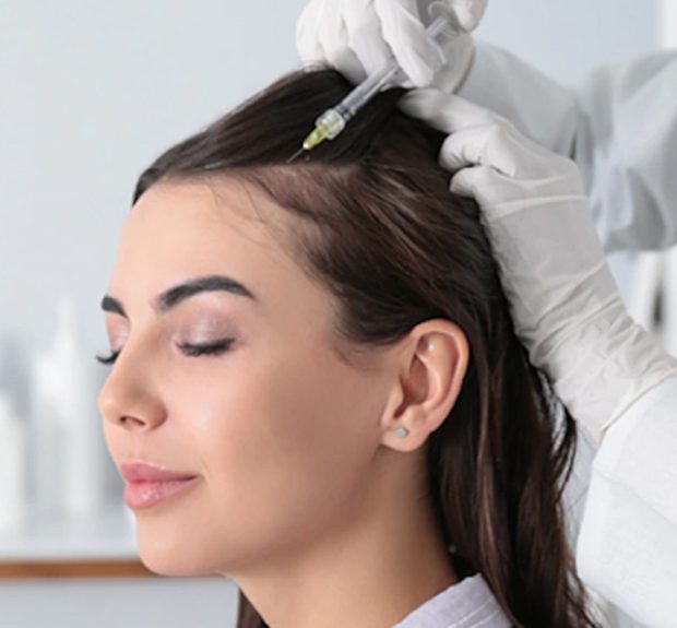 Mesotherapy for hair loss