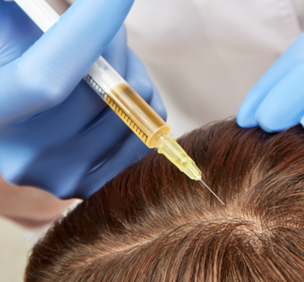 PRP hair therapy is a non-surgical procedure to enhance the hair follicles and promote renewed growth